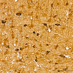 JNK1 Antibody in Immunohistochemistry (Paraffin) (IHC (P))