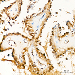 JNK1 Antibody in Immunohistochemistry (Paraffin) (IHC (P))