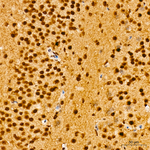 JNK1 Antibody in Immunohistochemistry (Paraffin) (IHC (P))