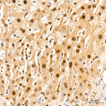 KPNB1 Antibody in Immunohistochemistry (Paraffin) (IHC (P))
