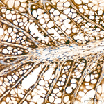 KPNB1 Antibody in Immunohistochemistry (Paraffin) (IHC (P))