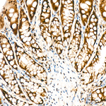 KPNB1 Antibody in Immunohistochemistry (Paraffin) (IHC (P))