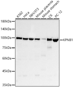 KPNB1 Antibody in Western Blot (WB)
