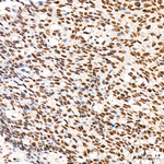 GLI1 Antibody in Immunohistochemistry (Paraffin) (IHC (P))