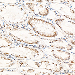 GLI1 Antibody in Immunohistochemistry (Paraffin) (IHC (P))