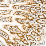 GLI1 Antibody in Immunohistochemistry (Paraffin) (IHC (P))