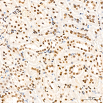 GLI1 Antibody in Immunohistochemistry (Paraffin) (IHC (P))