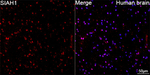 SIAH1 Antibody in Immunohistochemistry (Paraffin) (IHC (P))