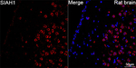 SIAH1 Antibody in Immunohistochemistry (Paraffin) (IHC (P))