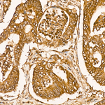 SIAH1 Antibody in Immunohistochemistry (Paraffin) (IHC (P))