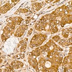 SIAH1 Antibody in Immunohistochemistry (Paraffin) (IHC (P))
