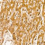 SIAH1 Antibody in Immunohistochemistry (Paraffin) (IHC (P))