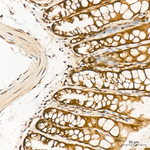 SIAH1 Antibody in Immunohistochemistry (Paraffin) (IHC (P))