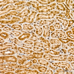 SIAH1 Antibody in Immunohistochemistry (Paraffin) (IHC (P))