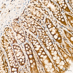 SIAH1 Antibody in Immunohistochemistry (Paraffin) (IHC (P))