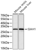 SIAH1 Antibody in Western Blot (WB)