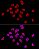 hnRNP D Antibody in Immunocytochemistry (ICC/IF)