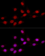 hnRNP D Antibody in Immunocytochemistry (ICC/IF)