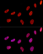 hnRNP D Antibody in Immunocytochemistry (ICC/IF)