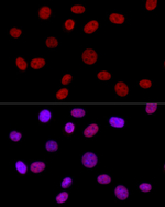 hnRNP D Antibody in Immunocytochemistry (ICC/IF)