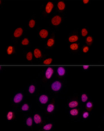 hnRNP D Antibody in Immunocytochemistry (ICC/IF)