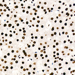 hnRNP D Antibody in Immunohistochemistry (Paraffin) (IHC (P))