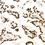 hnRNP D Antibody in Immunohistochemistry (Paraffin) (IHC (P))