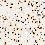 hnRNP D Antibody in Immunohistochemistry (Paraffin) (IHC (P))