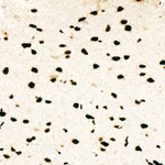 hnRNP D Antibody in Immunohistochemistry (Paraffin) (IHC (P))