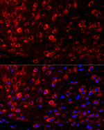 FABP7 Antibody in Immunohistochemistry (Paraffin) (IHC (P))