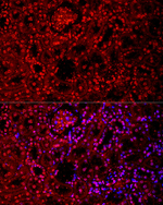 VDR Antibody in Immunohistochemistry (Paraffin) (IHC (P))