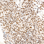 VDR Antibody in Immunohistochemistry (Paraffin) (IHC (P))