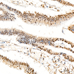 VDR Antibody in Immunohistochemistry (Paraffin) (IHC (P))