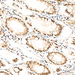 VDR Antibody in Immunohistochemistry (Paraffin) (IHC (P))