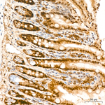 VDR Antibody in Immunohistochemistry (Paraffin) (IHC (P))