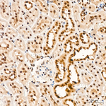 VDR Antibody in Immunohistochemistry (Paraffin) (IHC (P))