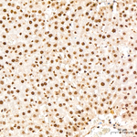 VDR Antibody in Immunohistochemistry (Paraffin) (IHC (P))
