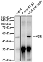 VDR Antibody in Immunoprecipitation (IP)