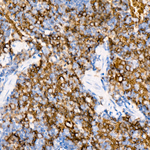 SLC14A1 Antibody in Immunohistochemistry (Paraffin) (IHC (P))