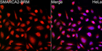 SMARCA2 Recombinant Rabbit Monoclonal Antibody (2G5O3)