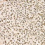 SMARCA2 Antibody in Immunohistochemistry (Paraffin) (IHC (P))