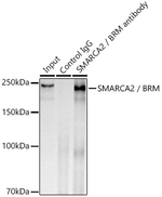 SMARCA2 Antibody in Immunoprecipitation (IP)