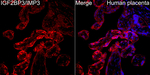 IGF2BP3 Recombinant Rabbit Monoclonal Antibody (4T4X7)