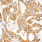 IGF2BP3 Antibody in Immunohistochemistry (Paraffin) (IHC (P))