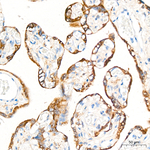 IGF2BP3 Antibody in Immunohistochemistry (Paraffin) (IHC (P))