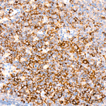 IGF2BP3 Antibody in Immunohistochemistry (Paraffin) (IHC (P))