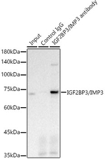 IGF2BP3 Antibody in Immunoprecipitation (IP)