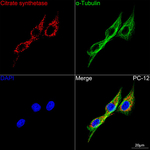 Citrate Synthase Antibody in Immunocytochemistry (ICC/IF)