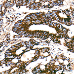 Citrate Synthase Antibody in Immunohistochemistry (Paraffin) (IHC (P))