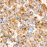 Citrate Synthase Antibody in Immunohistochemistry (Paraffin) (IHC (P))